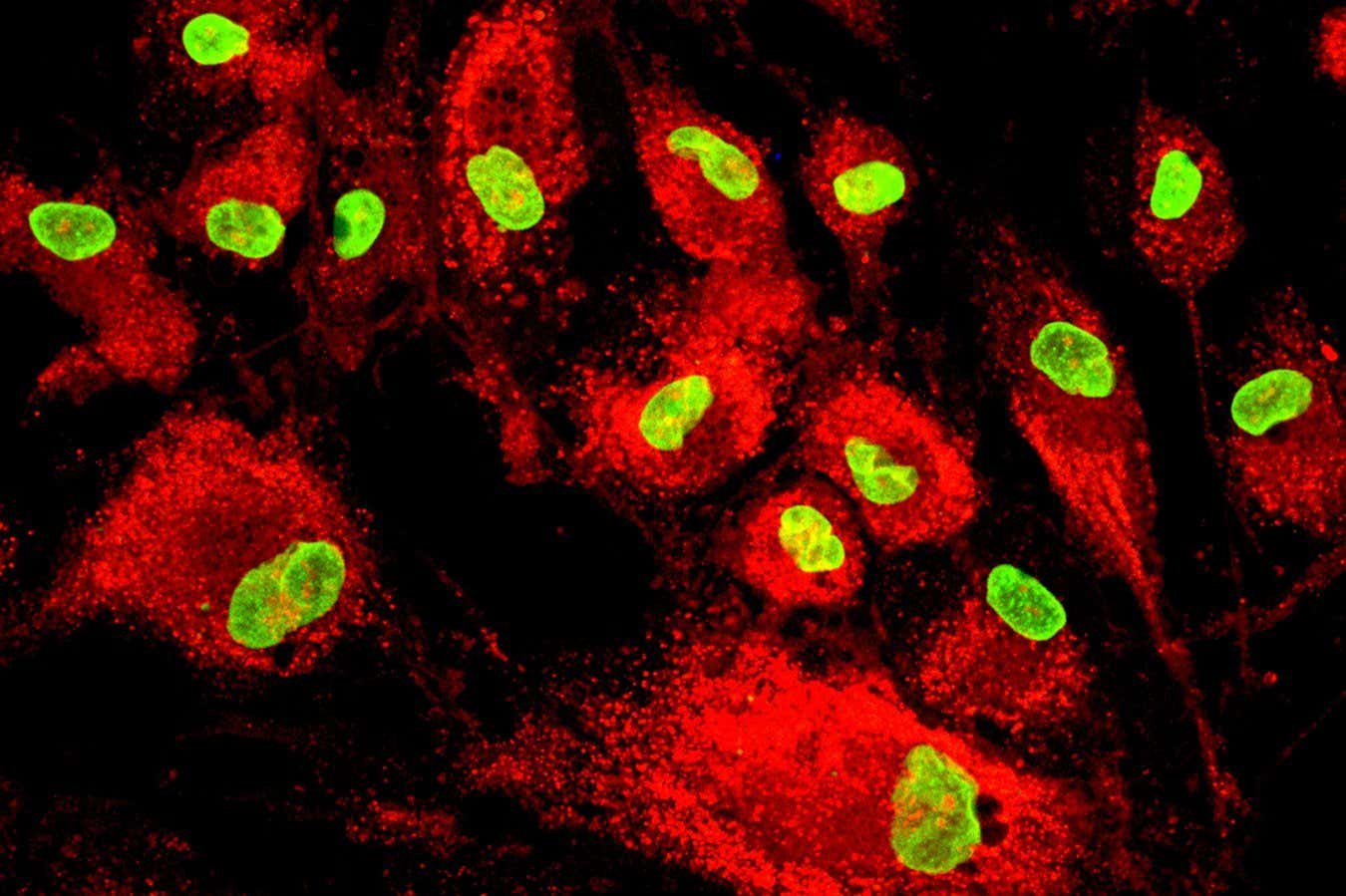 Stem cell therapy lowers the risk of heart failure after a heart attack